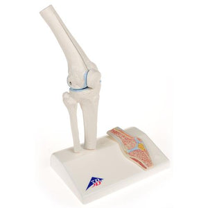 Mini-articulation du genou avec coupe transversale, sur socle - Anatomie et pathologie