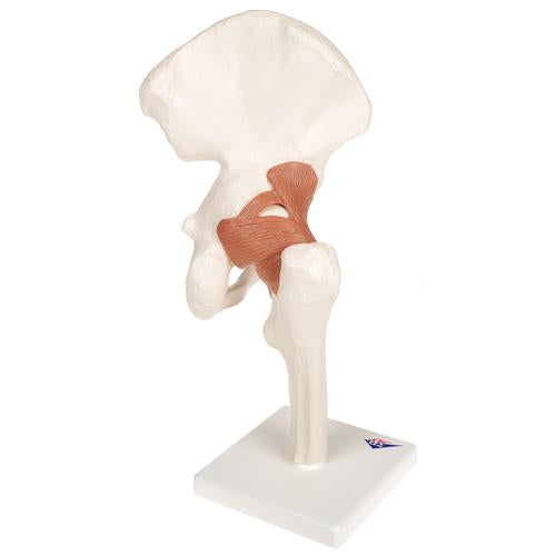 Articulation de la hanche - Modèle fonctionnel - Anatomie et pathologie